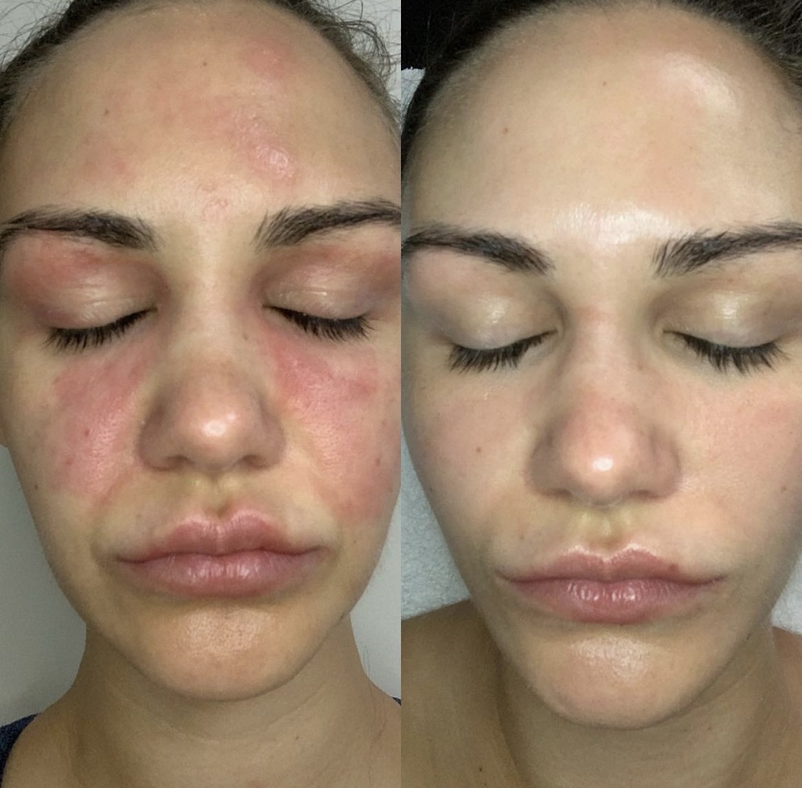 Vital Effect Skin and Health